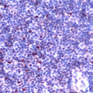 Find Out More About The FOXP3 Antibody