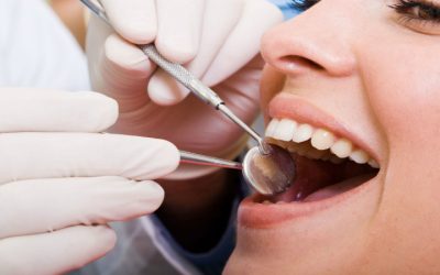 Why You May Need Emergency Dental Care Near Madison, WI